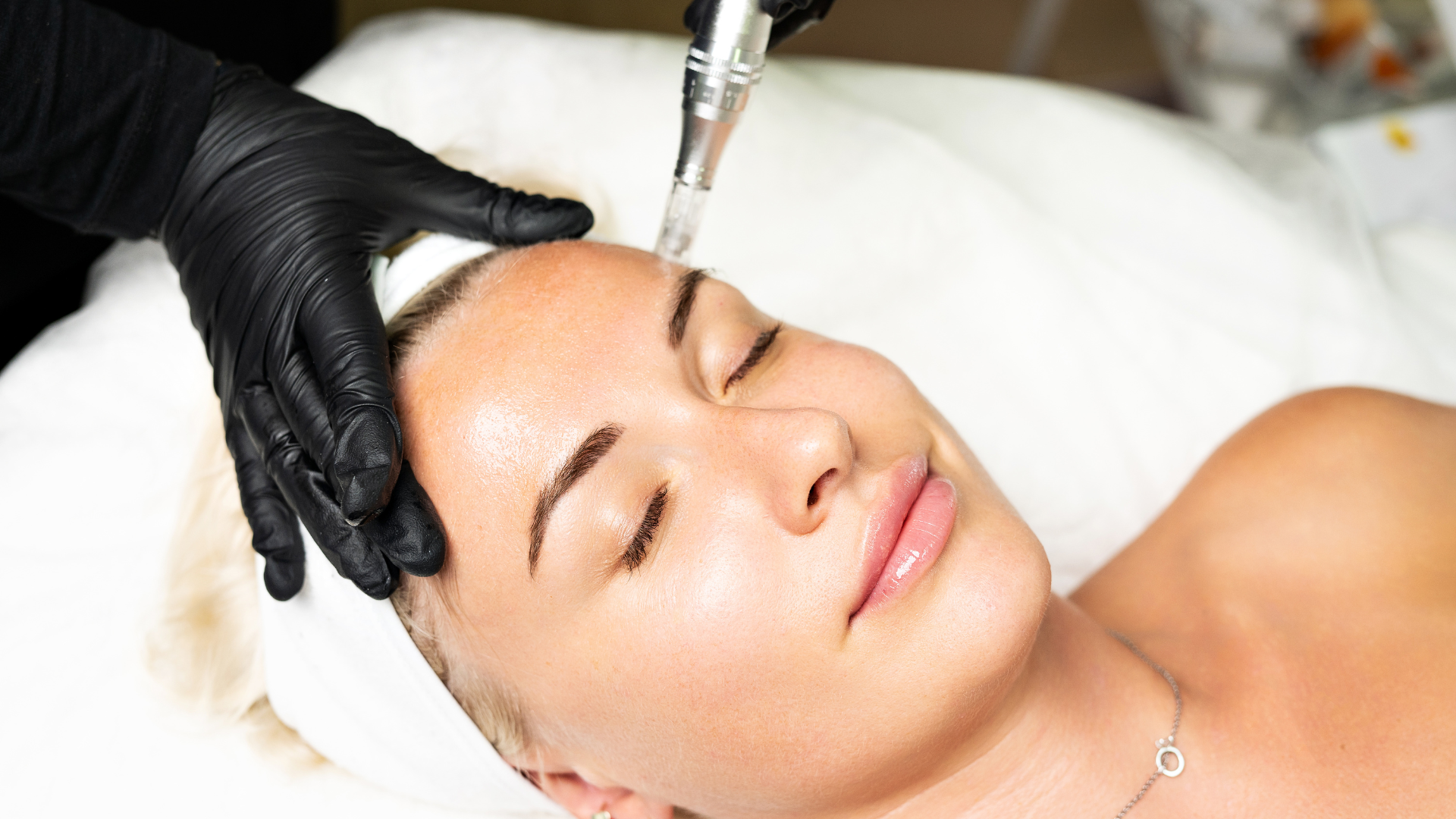 microneedlingtherapy