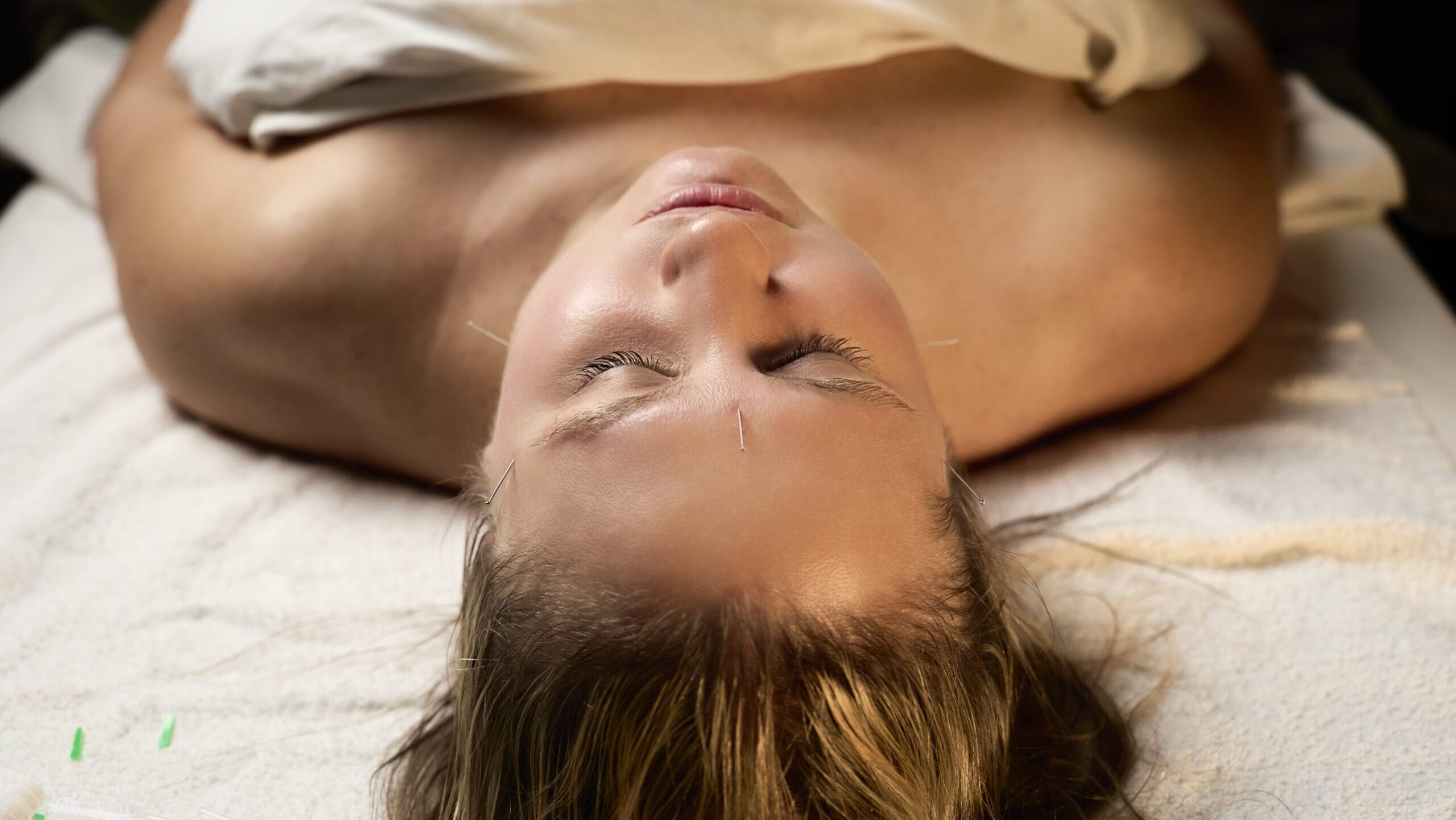 Facial acupuncture treatment at Bloor West Retreat in Toronto to rejuvenate skin and promote wellness