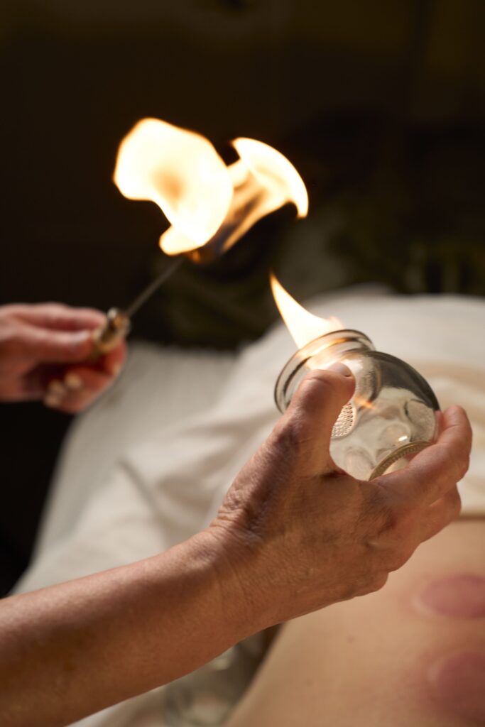 Fire cupping therapy session at Bloor West Retreat in Toronto for muscle tension relief and circulation