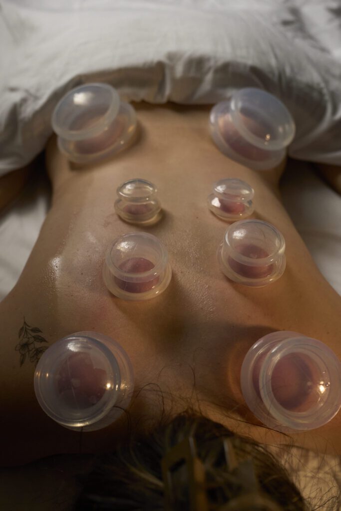 cupping-therapy.jpg acupuncture-treatment.jpg bamboo-cup-therapy..jpeg cupping-back-treatment.jpg cupping-full-back.jpg cupping-glass-cups..jpg cupping-holistic-care.jpg cupping-relax-spa.jpeg cupping-silicone-cups.jpg cupping-therapist-hands.jpg cupping-therapy-session.jpg