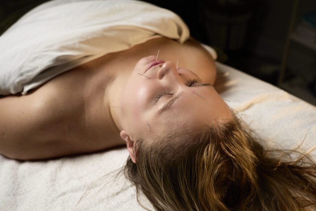 Facial acupuncture in Toronto at Bloor West Retreat to rejuvenate skin, reduce fine lines, and promote natural wellness.
